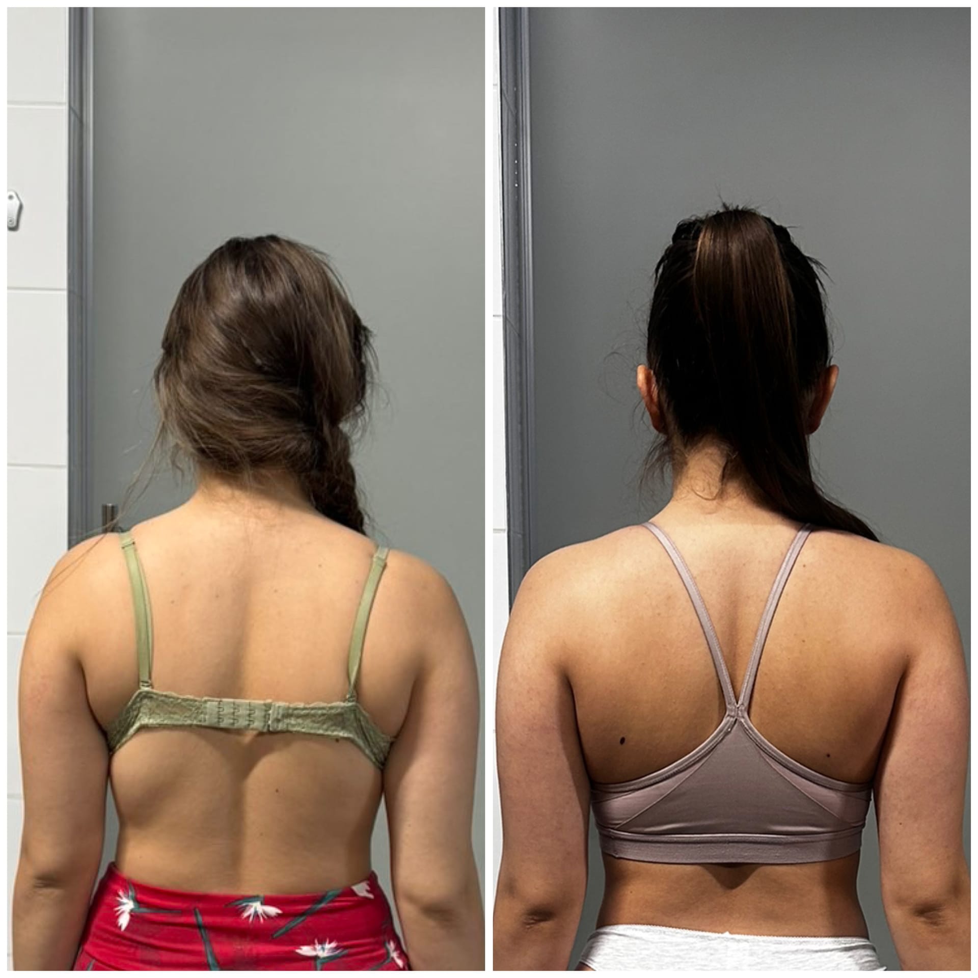 Jačanje leđa - pre i posle