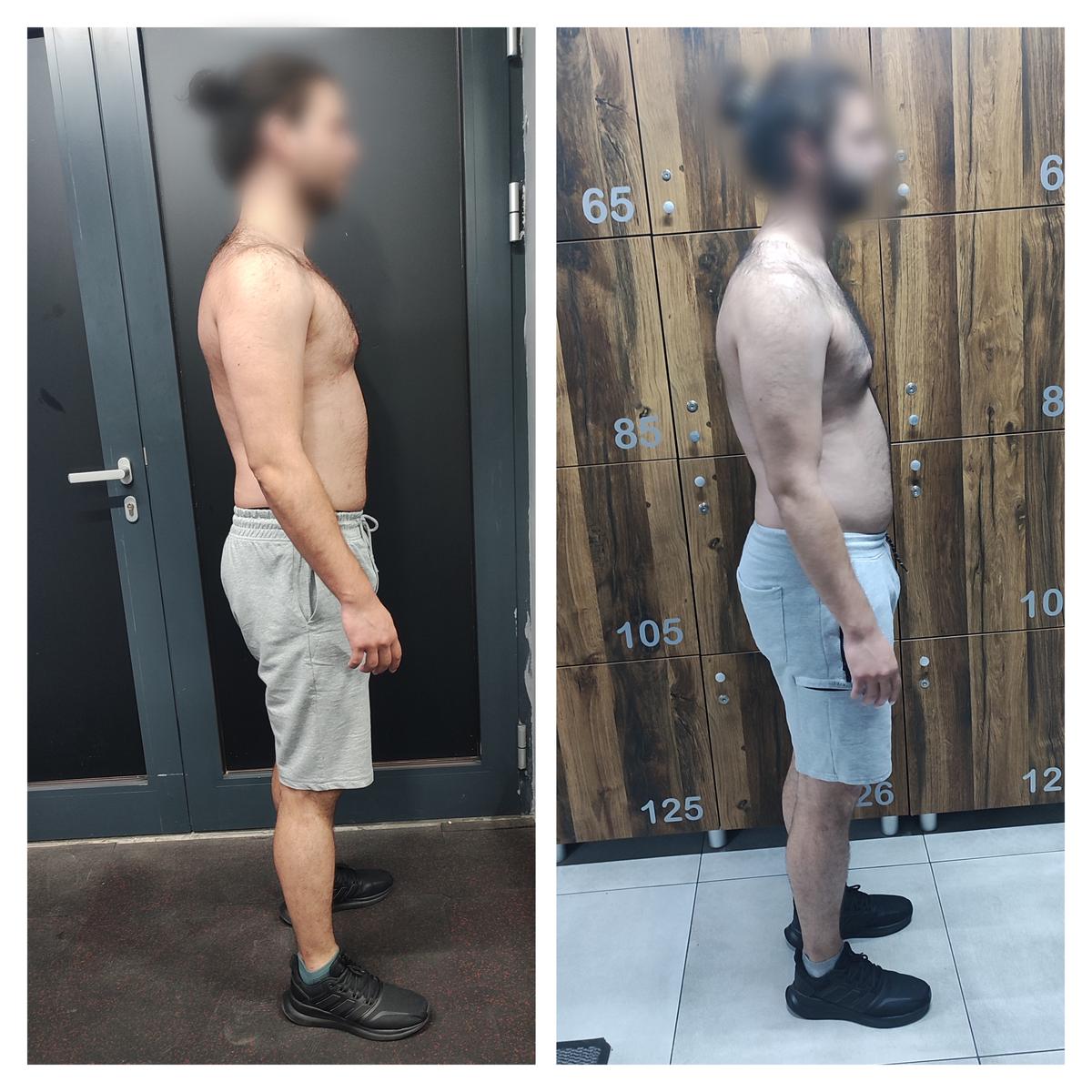 Poboljšanje posture - pre i posle